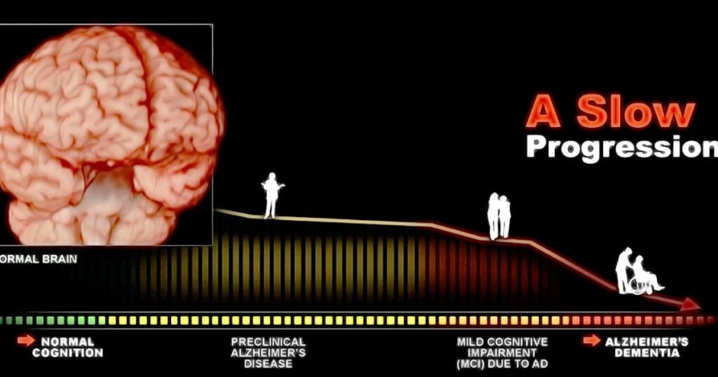 The Basics of Dementia and Cognitive