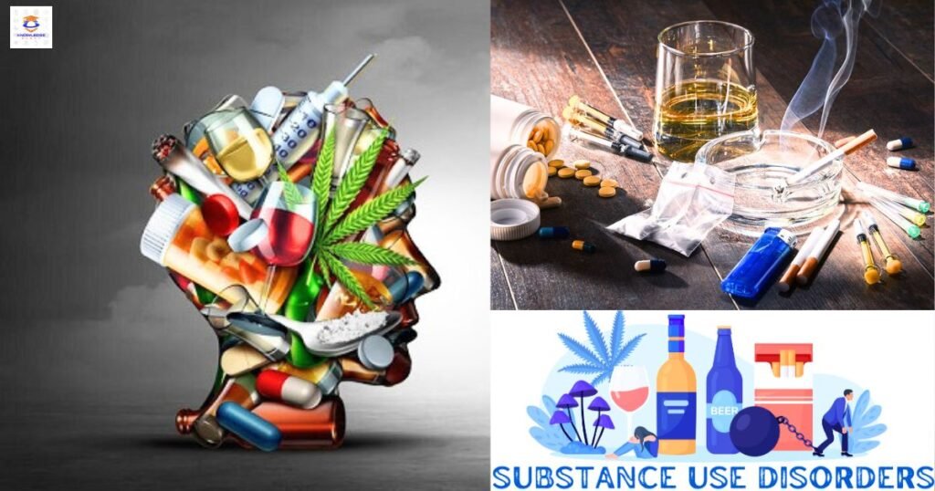 Substance Abuse Disorder Types, Symptoms, Causes, Diagnosis, Treatment