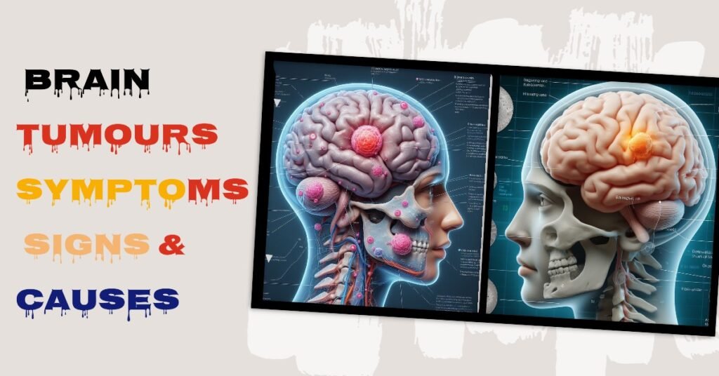 Human Brain Tumours Symptom