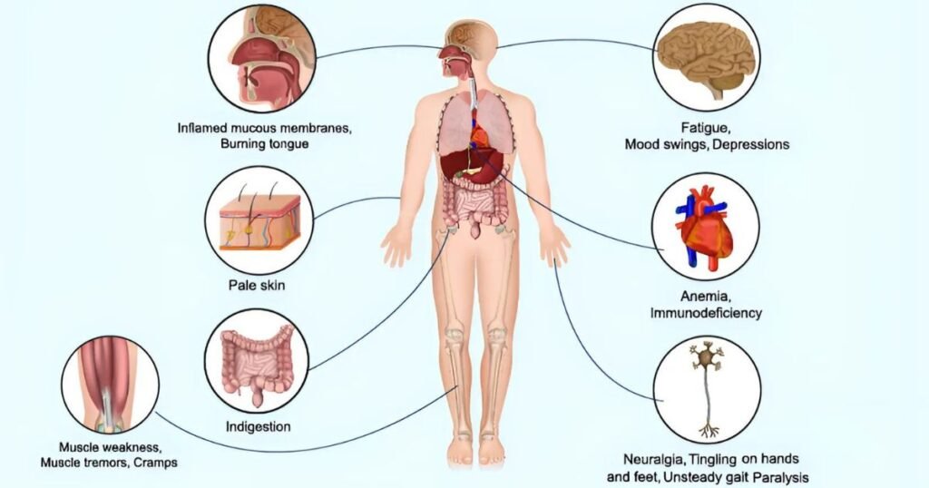 Vitamin B12 Deficiency Symptoms